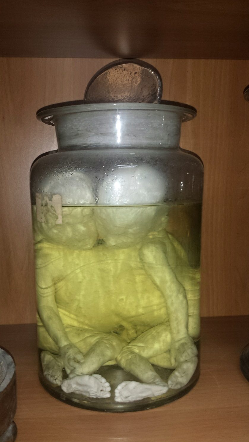 Antonio Cardarelli's Hospital anatomical preparations (6).jpg